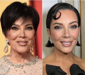 Kris Jenner’s massive face transformation Unmasked